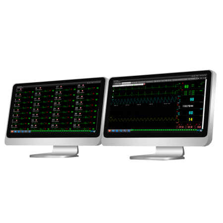 Sistema para Central de Monitoreo MFM-CMS -EDAN