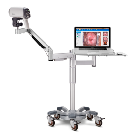 Videocolposcopio HD C6A iluminación LED brillante en frío