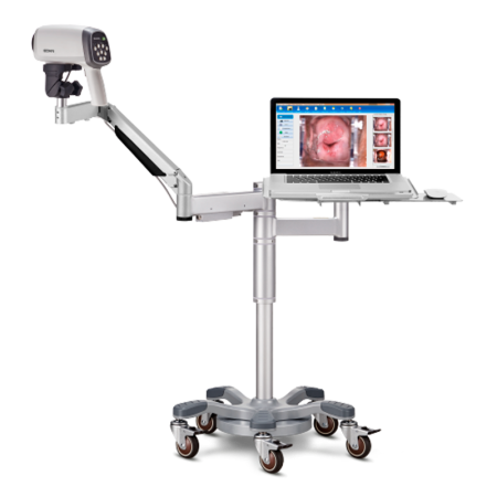 Videocolposcopio HD C6A iluminación LED brillante en frío